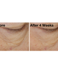 Two images of a woman's undereye area from The Eye Cure clinical trials. Image on the left displays woman's undereye area before using The Eye Cure, and the image on the right shows her undereye area after using The Eye Cure for four weeks. 