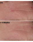 Two images of a man's brow from The Night Synthesis clinical trials. Image on the top displays man's brow before using The Night Synthesis, and the image on the bottom shows his brow after using The Night Synthesis for four weeks.